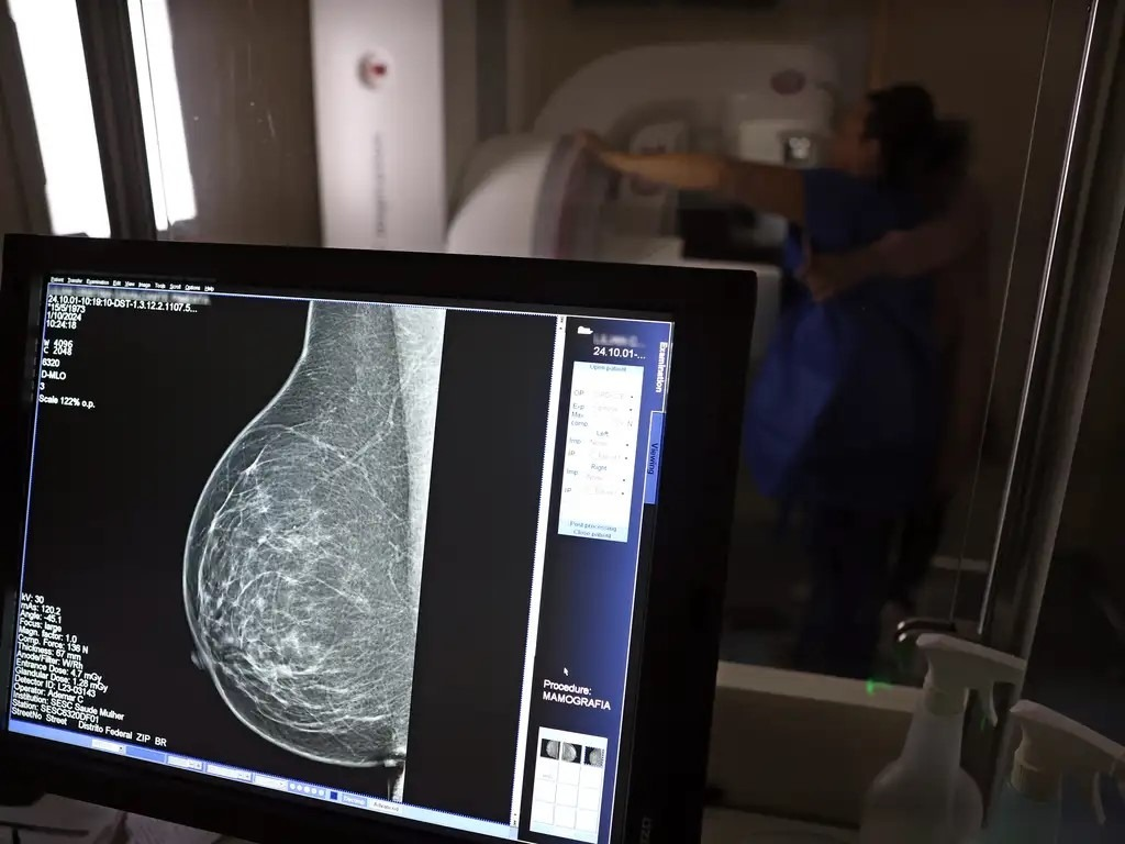 PBH amplia oferta de mamografias e reduz tempo de espera para 10 dias 