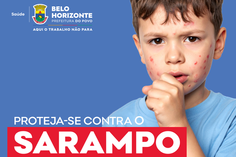 cartaz informativo, reforçando a importância da vacinação contra o Sarampo. A imagem mostra uma criança, com a mão junto à boca em gesto de tosse. Seu rosto, testa e pescoço apresentam várias pintas e manchas vermelhas espalhadas, sintomas do sarampo.