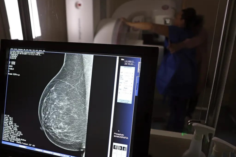 PBH amplia oferta de mamografias e reduz tempo de espera para 10 dias 