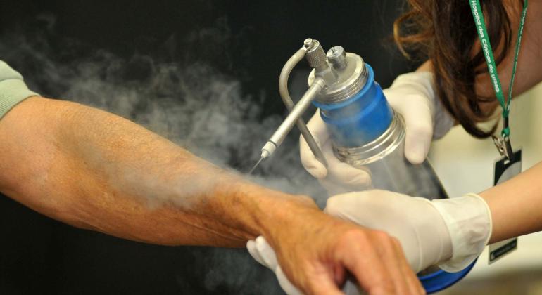 BH recebe mutirão de exames de prevenção ao câncer de pele Servidora do Hospital das Clínicas realiza exame de cancer de pele no braço de um cidadão