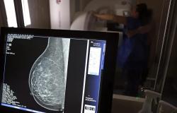 PBH investe em exames de mamografia e calcula 83 mil atendimentos em 2025